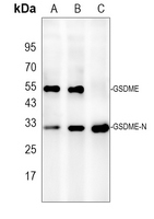 DFNA5 Rabbit Polyclonal Antibody