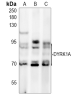 DYRK1A Rabbit Polyclonal Antibody