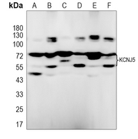Kir3.4 Rabbit Polyclonal Antibody