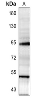 SMAD7 Rabbit Polyclonal Antibody