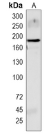 ABCA8 Rabbit Polyclonal Antibody