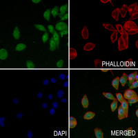 HIPK2 Rabbit Polyclonal Antibody