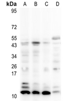 ATP8 Rabbit Polyclonal Antibody