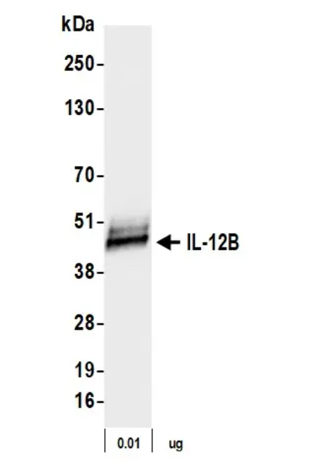 Rabbit anti-IL-12B Recombinant Monoclonal Antibody