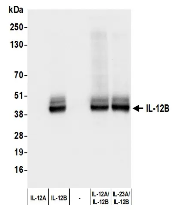 Rabbit anti-IL-12B Recombinant Monoclonal Antibody