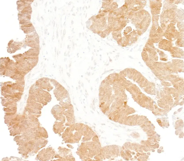 Rabbit anti-p16INK4a Recombinant Monoclonal Antibody