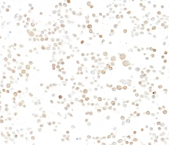 Rabbit anti-p16INK4a Recombinant Monoclonal Antibody