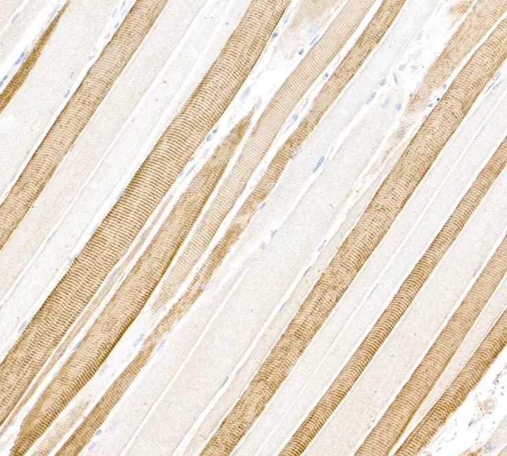 Mouse anti- Myosin Light Chain 1 Monoclonal Antibody