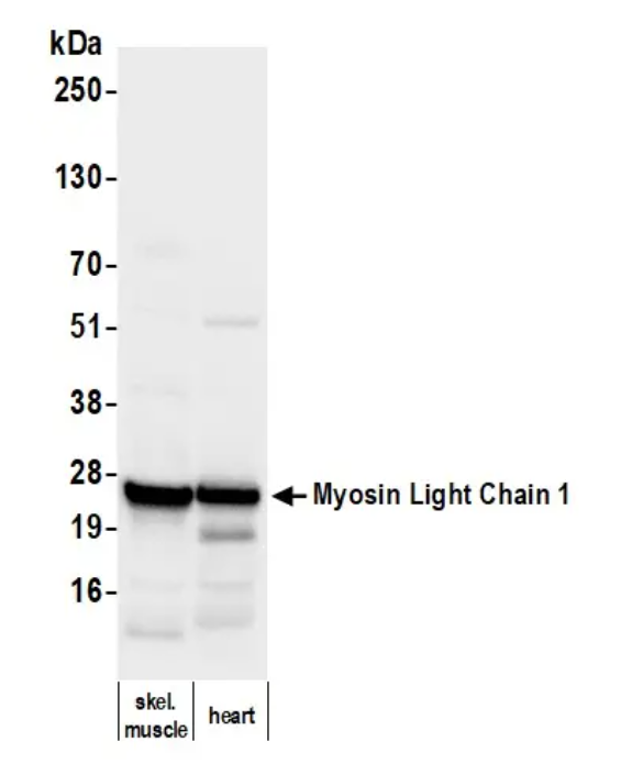 Mouse anti- Myosin Light Chain 1 Monoclonal Antibody
