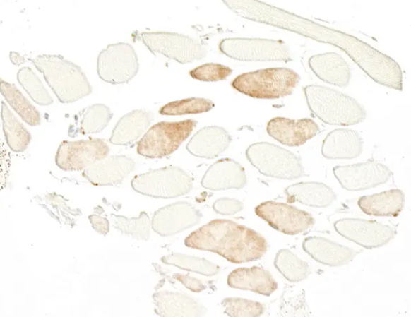 Mouse anti-Skeletal Troponin I Monoclonal Antibody