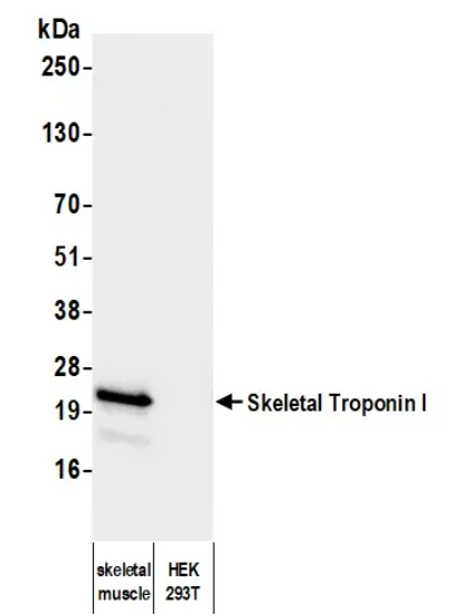 Mouse anti-Skeletal Troponin I Monoclonal Antibody