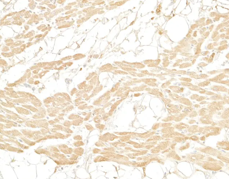 Mouse anti-Myoglobin Monoclonal Antibody