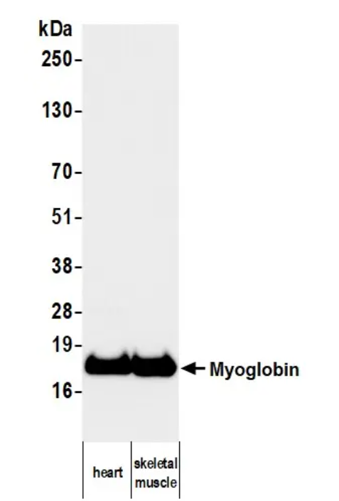 Mouse anti-Myoglobin Monoclonal Antibody