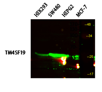 TM4SF19 rabbit pAb Antibody