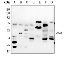 AChE Q Rabbit Polyclonal Antibody