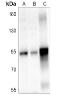 ITIH3 Rabbit Polyclonal Antibody