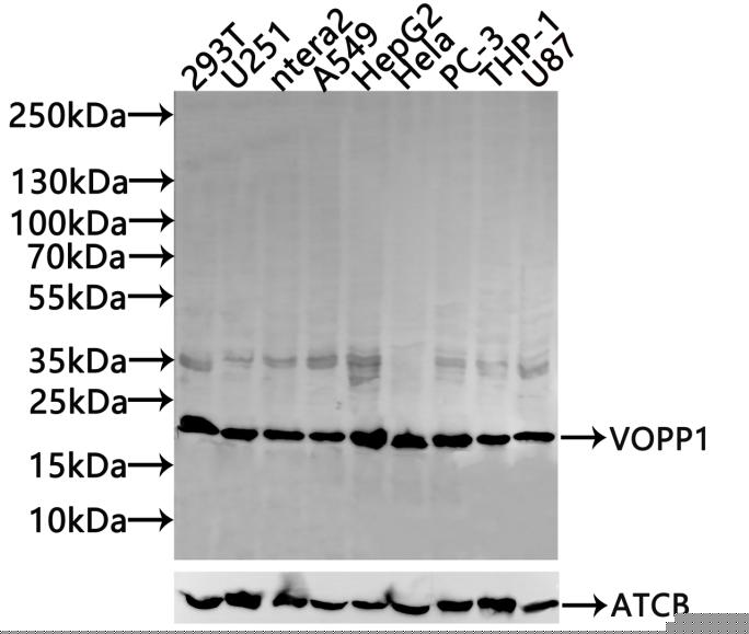 VOPP1 Antibody