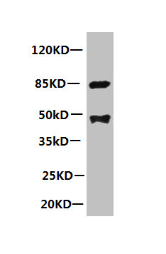 PLA2G7 Monoclonal Antibody