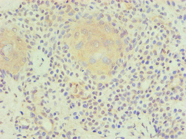 PLA2G7 Monoclonal Antibody