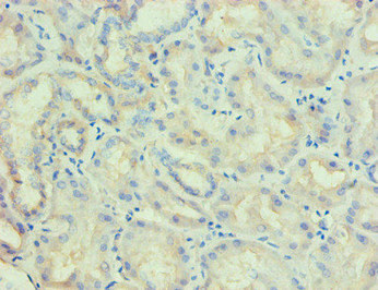 PLA2G7 Monoclonal Antibody