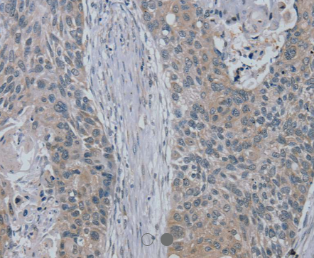 RASA4 Antibody