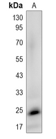 CRIF1 Rabbit Polyclonal Antibody