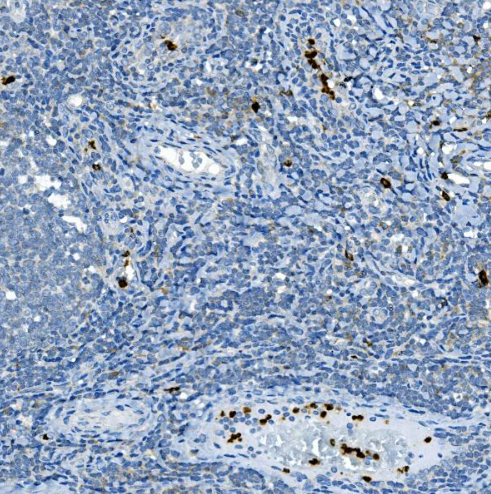 Anti-Myeloperoxidase/MPO Antibody