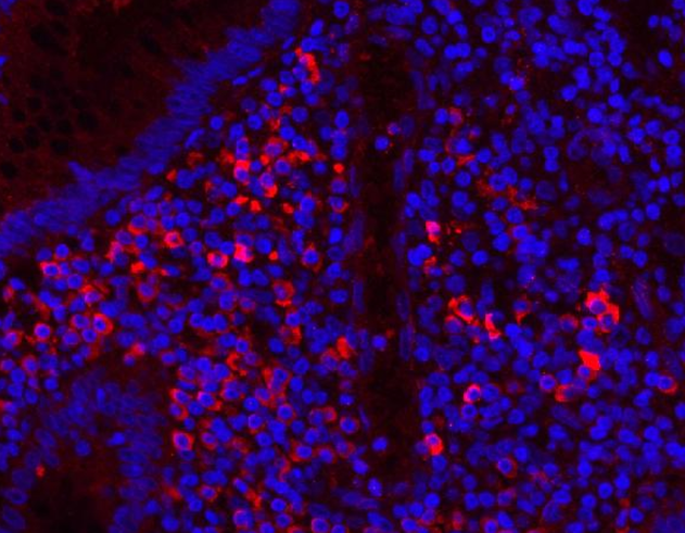 Anti-Myeloperoxidase/MPO Antibody