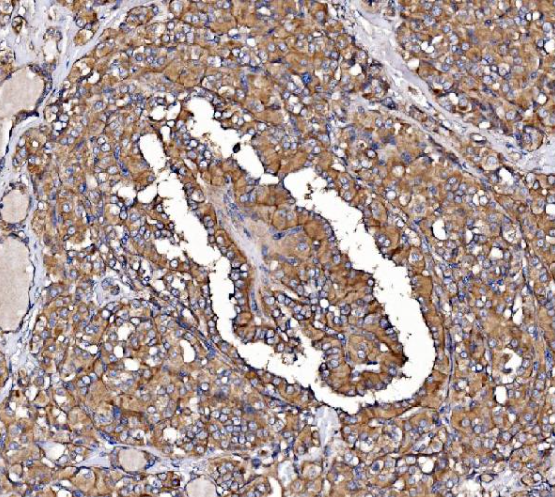 Anti-GPR54/KISS1R Antibody