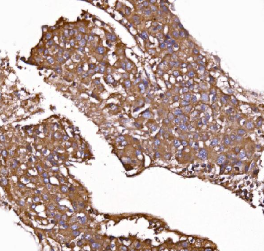 Anti-GPR54/KISS1R Antibody