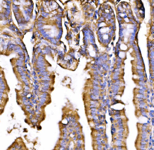 Anti-GPR54/KISS1R Antibody