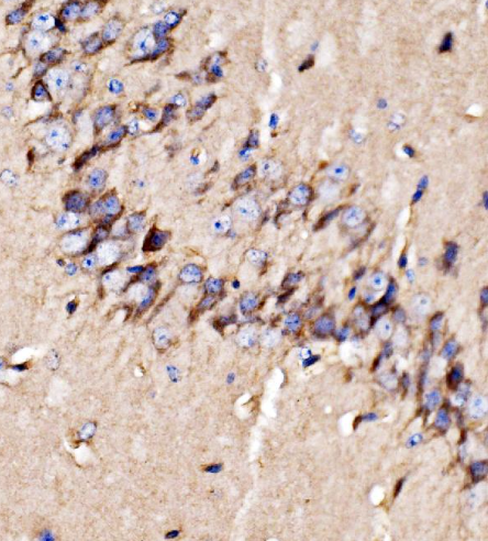 Anti-GPR54/KISS1R Antibody
