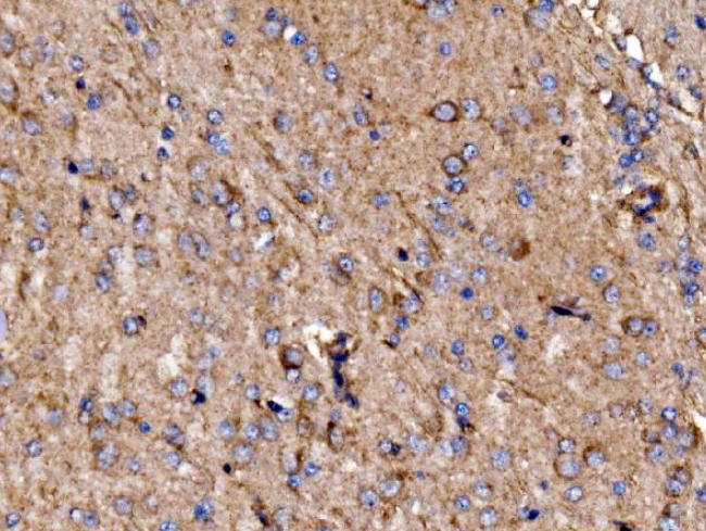 Anti-GPR54/KISS1R Antibody