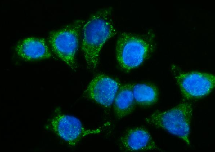 Anti-GPR54/KISS1R Antibody