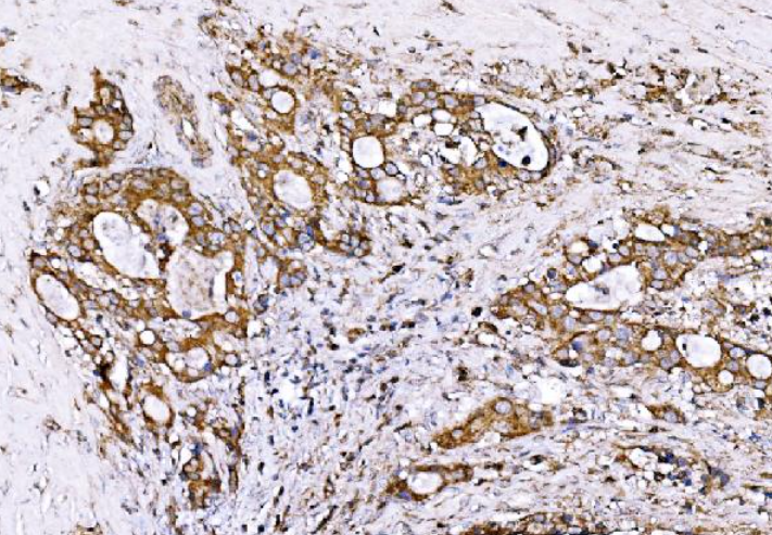 Anti-GPR54/KISS1R Antibody