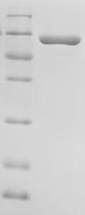 Recombinant Human Liver carboxylesterase 1 (CES1) (Active)