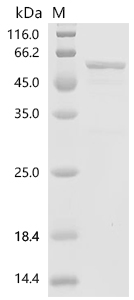 Recombinant Human LIM and SH3 domain protein 1 (LASP1), partial