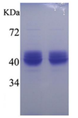 Recombinant Human Alpha-1 Antitrypsin