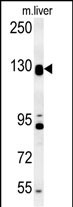 DENND5B Antibody (C-term)