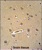 DENND5B Antibody (C-term)