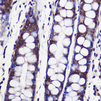 SPPL2a Rabbit Polyclonal Antibody