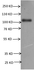 Recombinant Human Leucine-rich repeat-containing G-protein coupled receptor 5 (LGR5)-VLPs (Active)