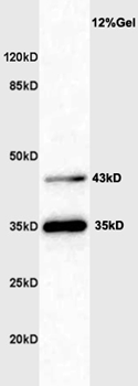 Shiga-like toxin IIe variant subunit A Rabbit pAb Antibody
