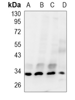 Cyclin D1 Rabbit Polyclonal Antibody