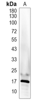C6orf52 Rabbit Polyclonal Antibody