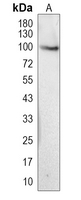KIF18B Rabbit Polyclonal Antibody