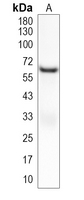 MUC21 Rabbit Polyclonal Antibody