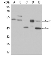 MEIS1 Rabbit Polyclonal Antibody