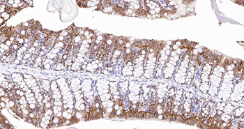 CLDN7 Mouse mAb