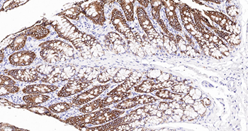 CLDN7 Mouse mAb